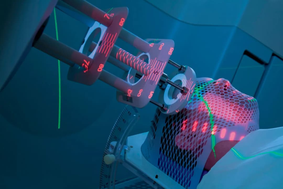 Skutki uboczne podania izotopu: czy terapia izotopowa jest bezpieczna?