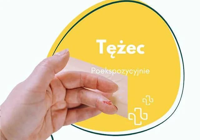 Skutki uboczne szczepienia na tężec: co warto wiedzieć o reakcjach?
