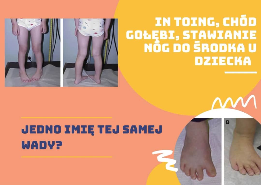 Gołębi chód u dzieci: przyczyny, objawy i skuteczne leczenie