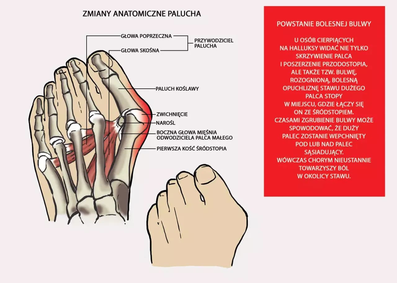 Duży palec u stopy: funkcje, problemy i jak o niego dbać
