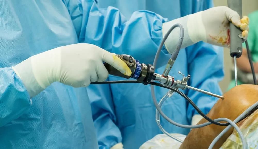 Skutki uboczne artroskopii kolana: ważne informacje i ryzyka, które musisz znać