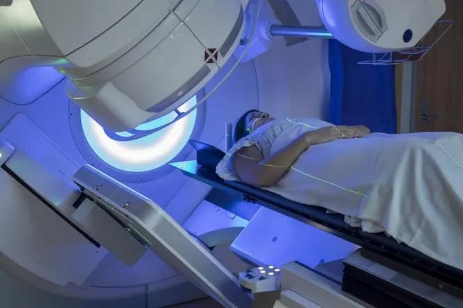 Skutki uboczne radioterapii prostaty – co warto wiedzieć i jak łagodzić objawy