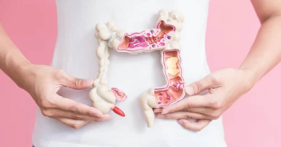 Stolec przy raku jelita grubego: Kluczowe objawy i zmiany