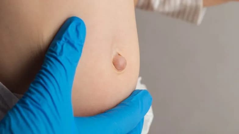 Przepuklina kresy białej u dziecka: objawy, leczenie, powikłania