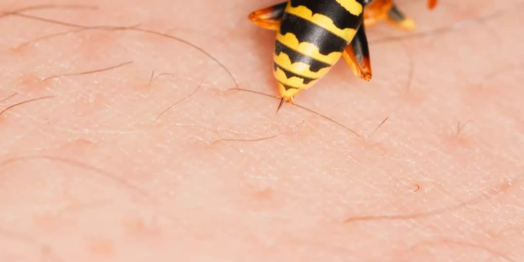 Skutki uboczne odczulania na jad osy: jakie reakcje mogą wystąpić?