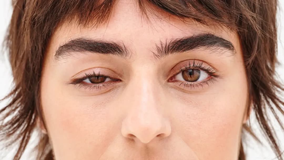 Skutki uboczne botoksu – jakie zagrożenia mogą cię zaskoczyć?